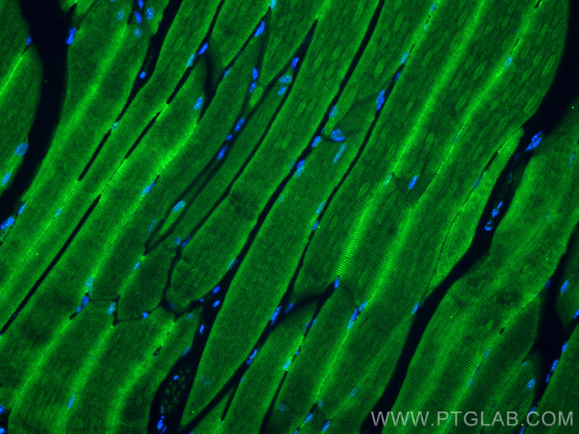 Immunofluorescence (IF) / fluorescent staining of mouse skeletal muscle tissue using MYBPC2 Polyclonal antibody (25257-1-AP)