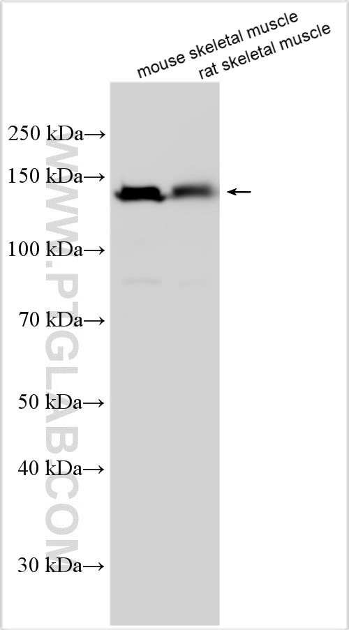 Western Blot (WB) analysis of various lysates using MYBPC2 Polyclonal antibody (25257-1-AP)