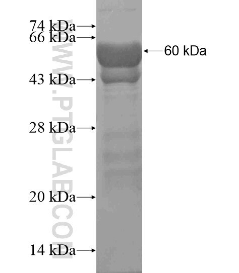 MYBPC2 fusion protein Ag19424 SDS-PAGE