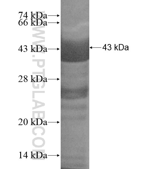 MYBPC2 fusion protein Ag19621 SDS-PAGE MYBPC2 fusion protein Ag19621 SDS-PAGE