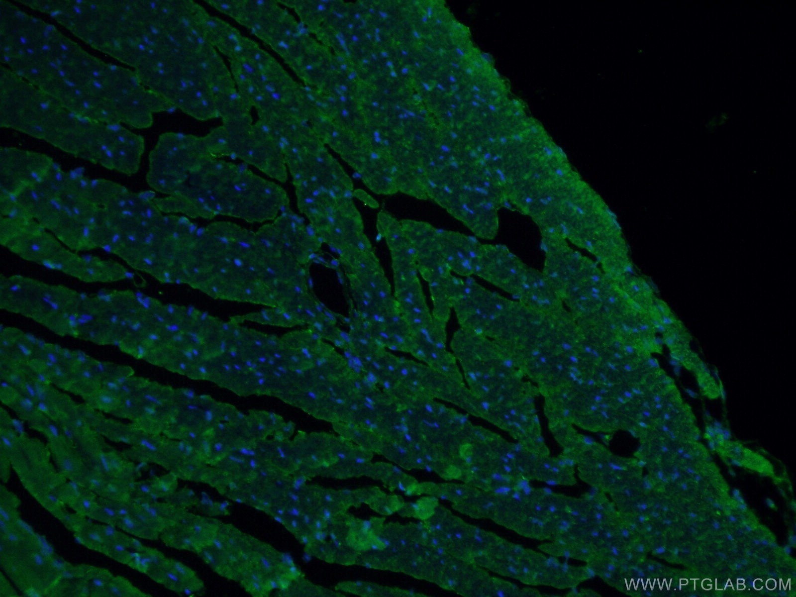 Immunofluorescence (IF) / fluorescent staining of mouse heart tissue using MYBPC3 Polyclonal antibody (19977-1-AP)