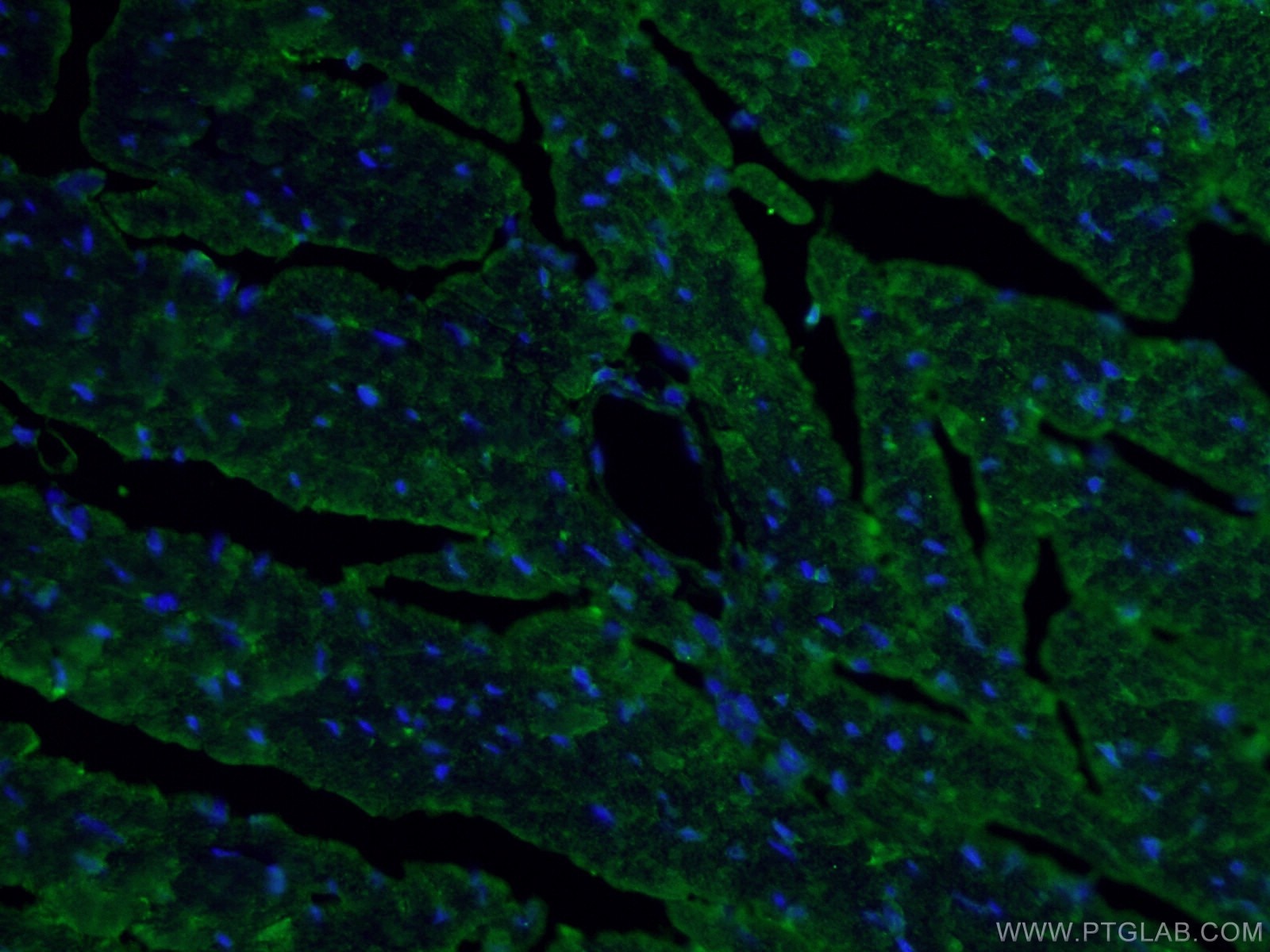 Immunofluorescence (IF) / fluorescent staining of mouse heart tissue using MYBPC3 Polyclonal antibody (19977-1-AP)