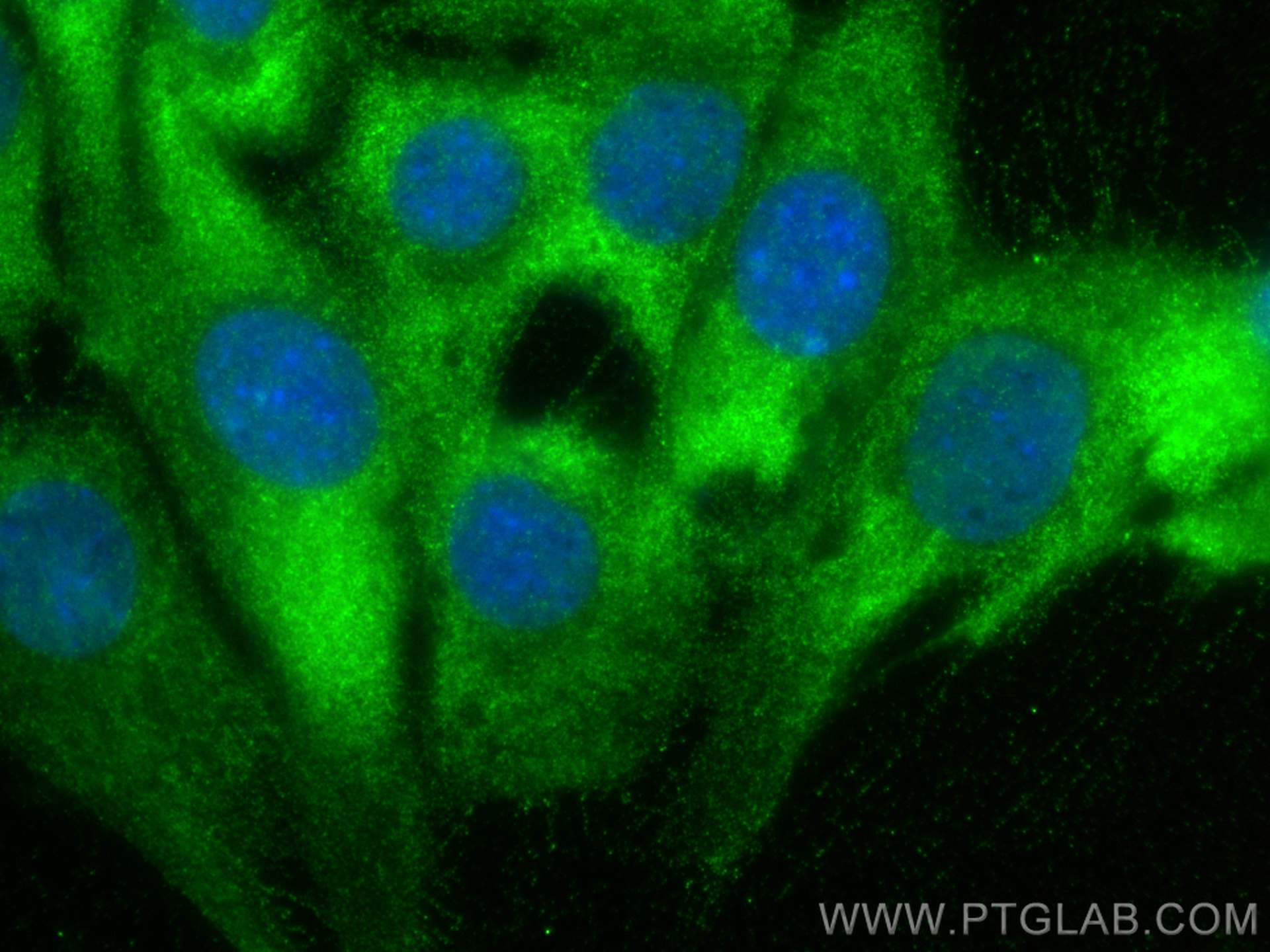 Immunofluorescence (IF) / fluorescent staining of C2C12 cells using MYBPC3 Polyclonal antibody (19977-1-AP)