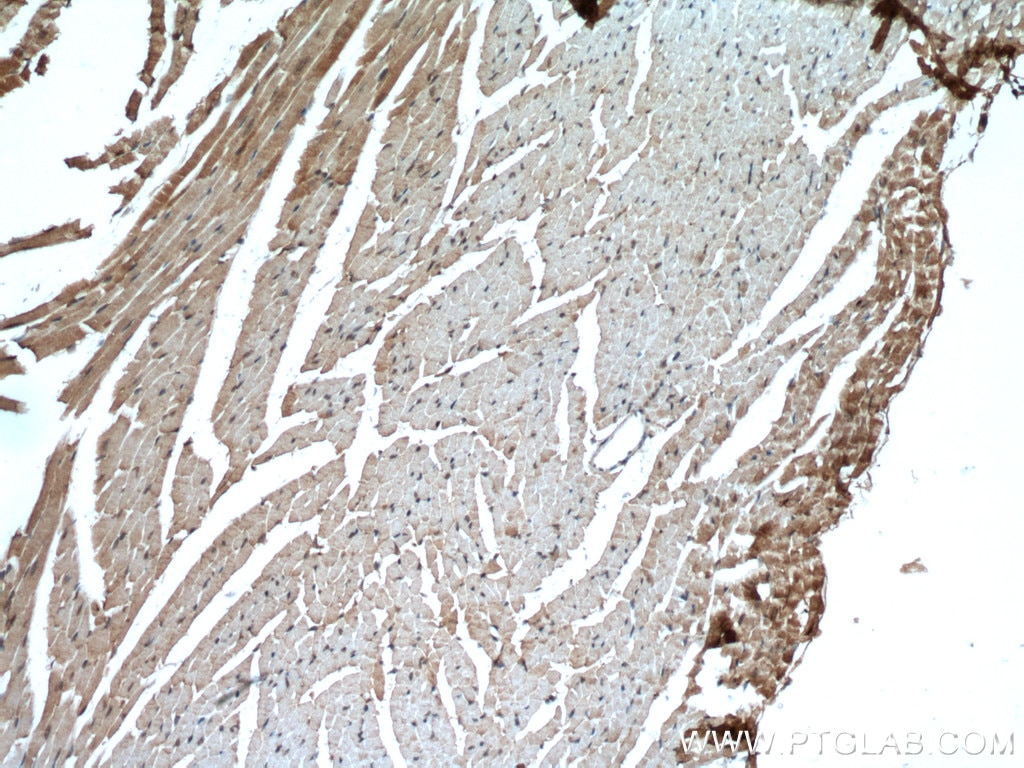 Immunohistochemistry (IHC) staining of mouse heart tissue using MYBPC3 Polyclonal antibody (19977-1-AP)