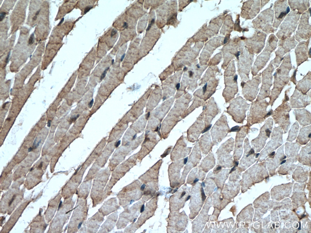 Immunohistochemistry (IHC) staining of mouse heart tissue using MYBPC3 Polyclonal antibody (19977-1-AP)