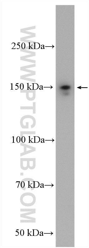 Western Blot (WB) analysis of rat heart tissue using MYBPC3 Polyclonal antibody (19977-1-AP)