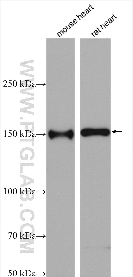 Western Blot (WB) analysis of various lysates using MYBPC3 Polyclonal antibody (19977-1-AP)