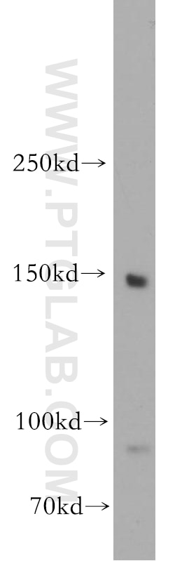 Western Blot (WB) analysis of human heart tissue using MYBPC3 Polyclonal antibody (19977-1-AP)