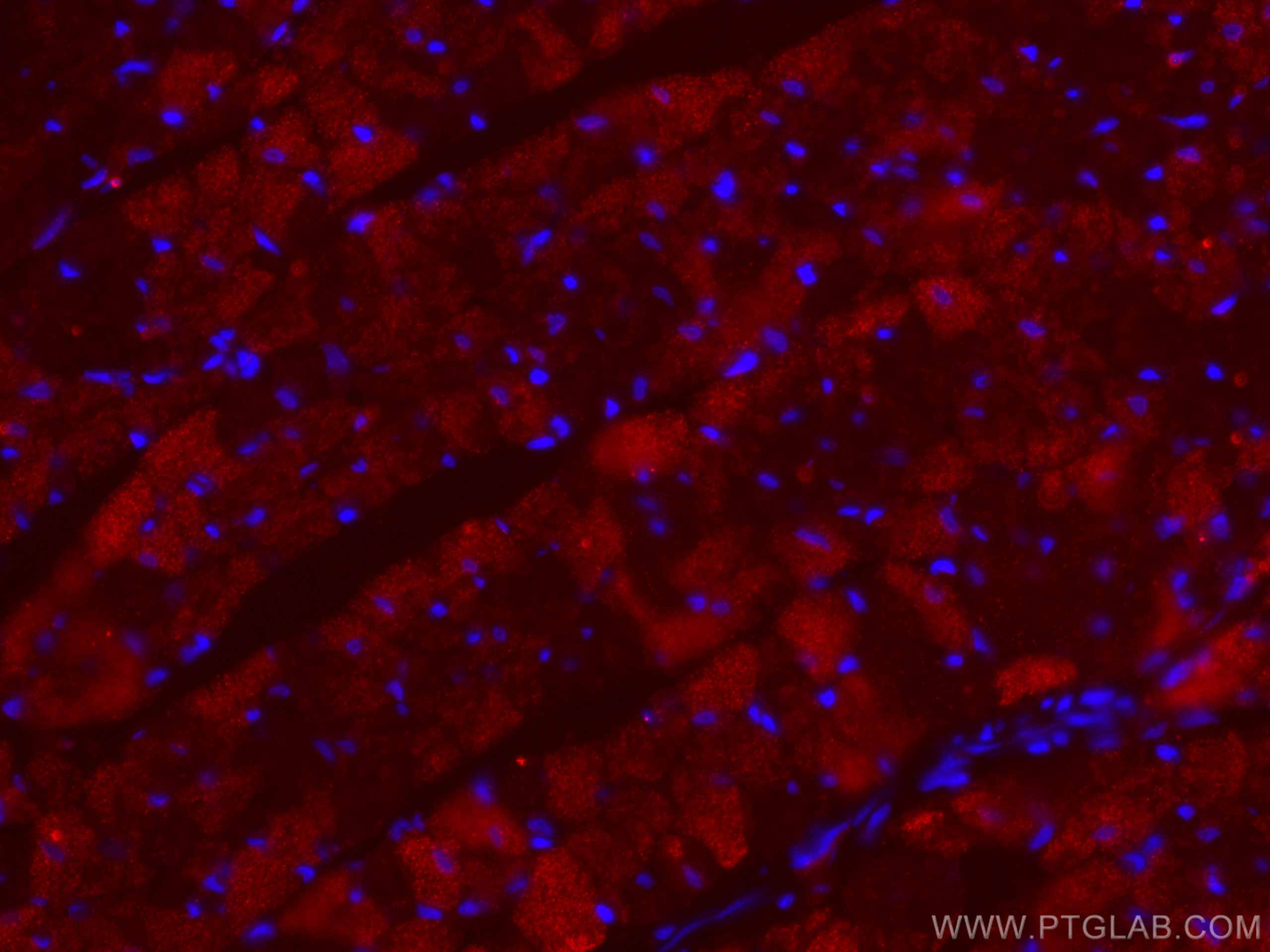 Immunofluorescence (IF) / fluorescent staining of rat heart tissue using MYBPC3 Monoclonal antibody (67608-1-Ig)