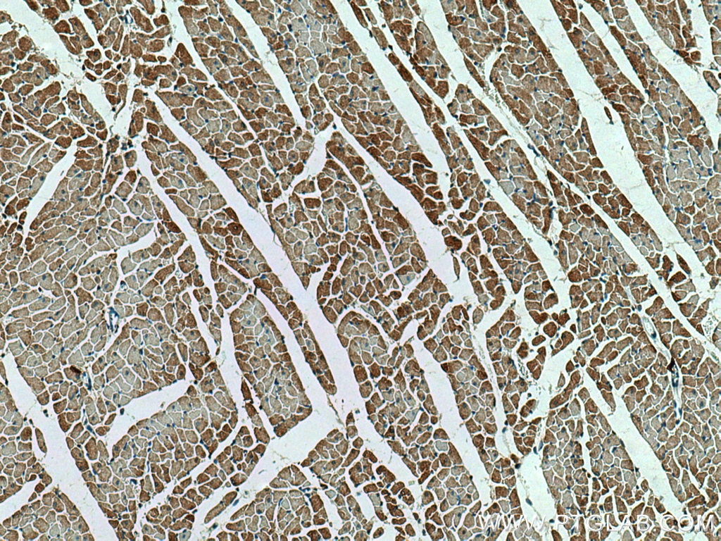 Immunohistochemistry (IHC) staining of rat heart tissue using MYBPC3 Monoclonal antibody (67608-1-Ig)