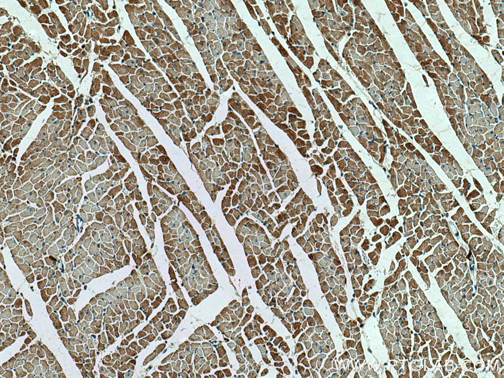 IHC staining of rat heart using 67608-1-Ig