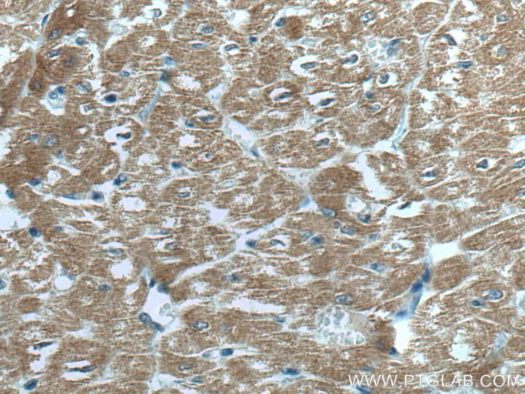 Immunohistochemistry (IHC) staining of human heart tissue using MYBPC3 Monoclonal antibody (67608-1-Ig)