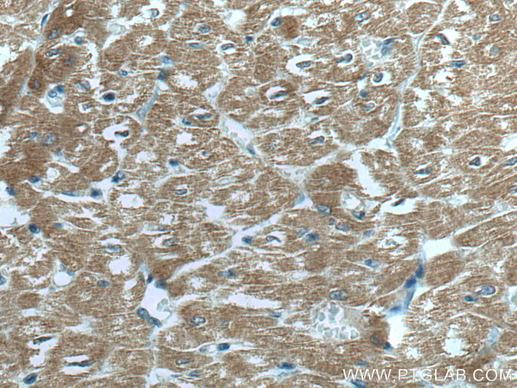 IHC staining of human heart using 67608-1-Ig