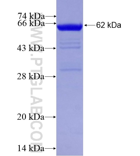 MYBPC3 fusion protein Ag15685 SDS-PAGE