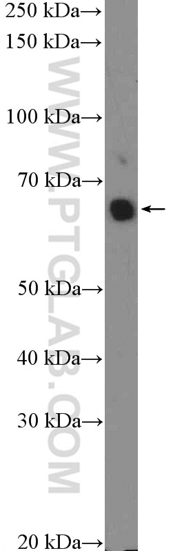 Western Blot (WB) analysis of NCCIT cells using c-Myc Polyclonal antibody (10057-1-AP)