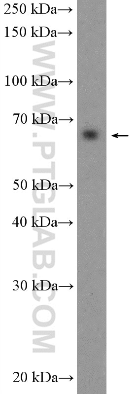 Western Blot (WB) analysis of HeLa cells using c-Myc Polyclonal antibody (10057-1-AP)