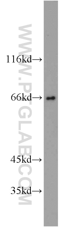 c-Myc Polyclonal antibody
