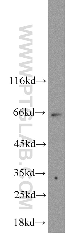Western Blot (WB) analysis of HeLa cells using c-Myc Polyclonal antibody (10057-1-AP)