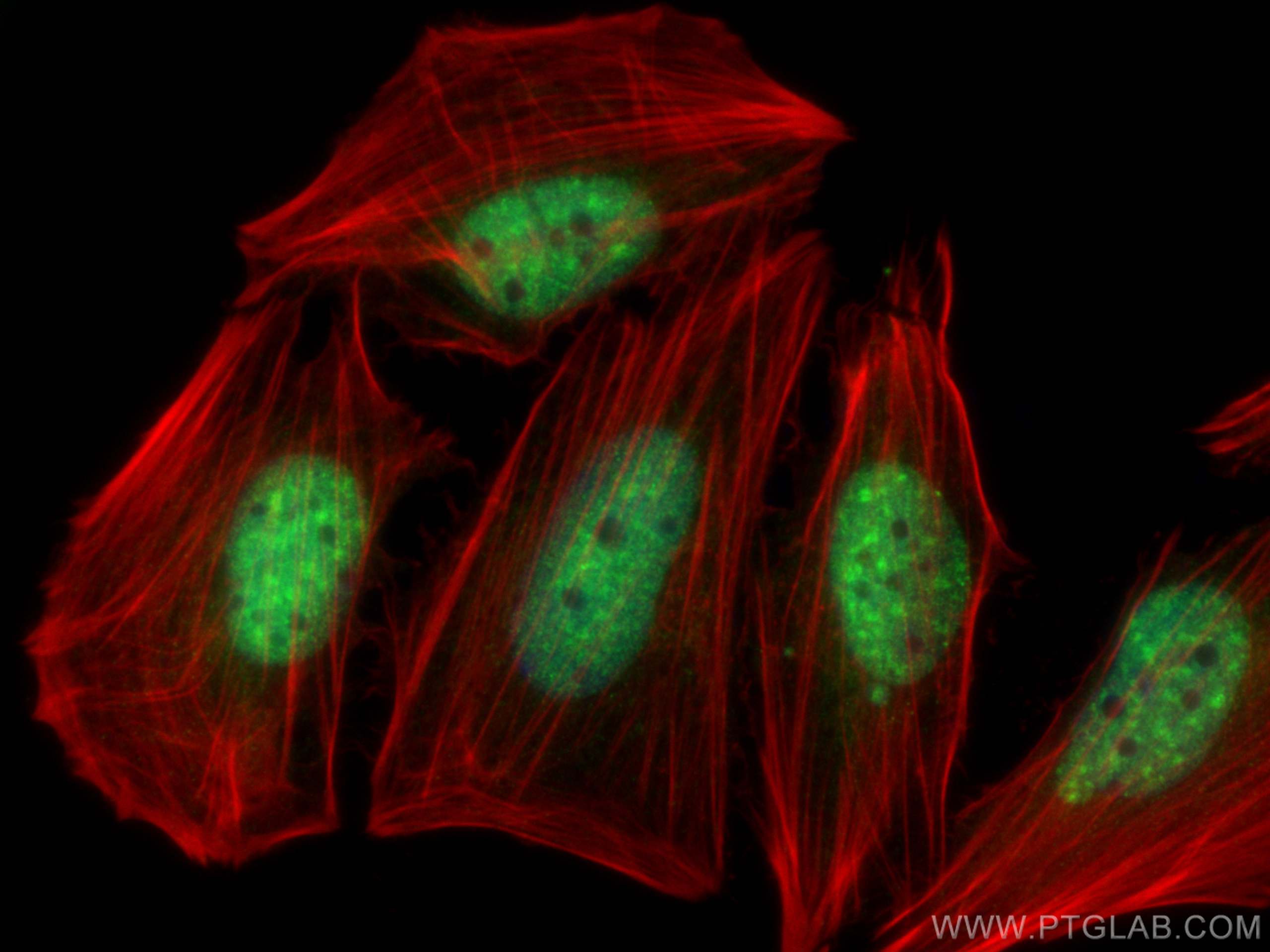 IF Staining of Saos-2 using 10828-1-AP