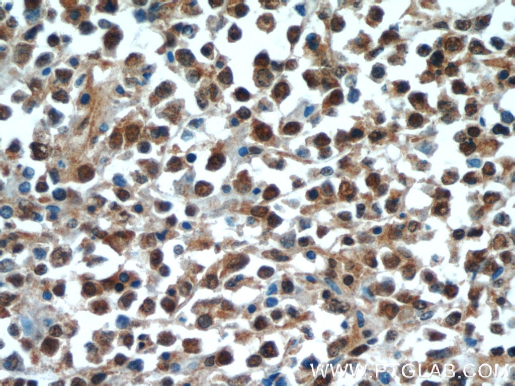 c-MYC Polyclonal antibody