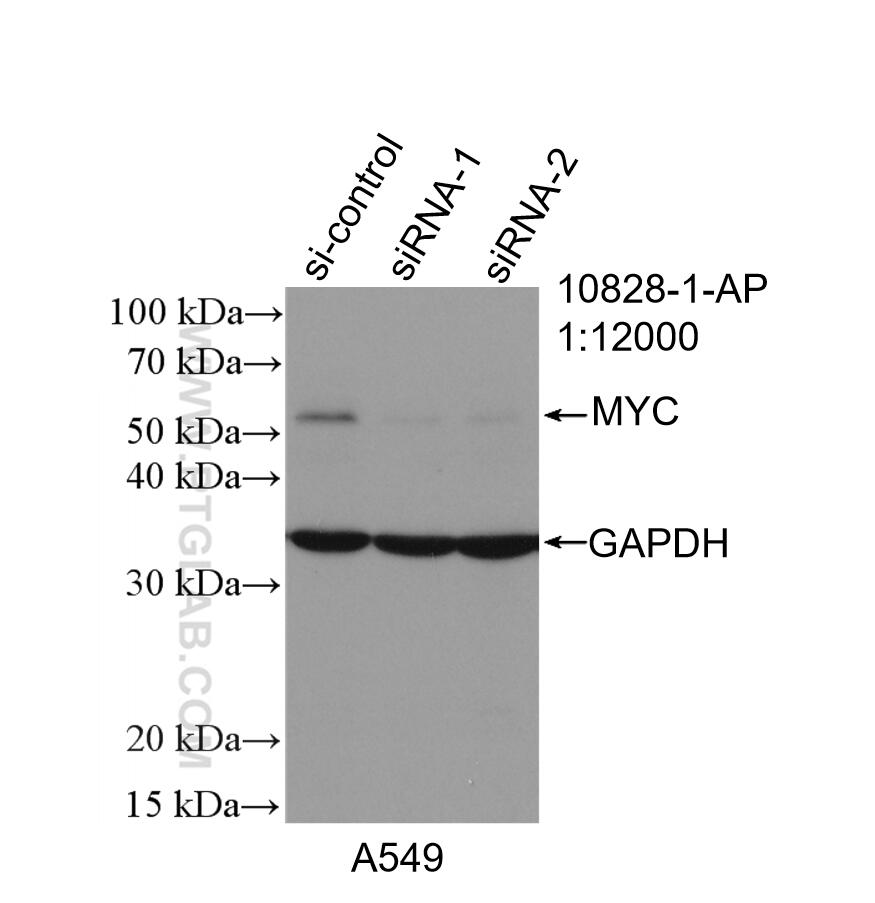 Western Blot (WB) analysis of A549 cells using c-MYC Polyclonal antibody (10828-1-AP)