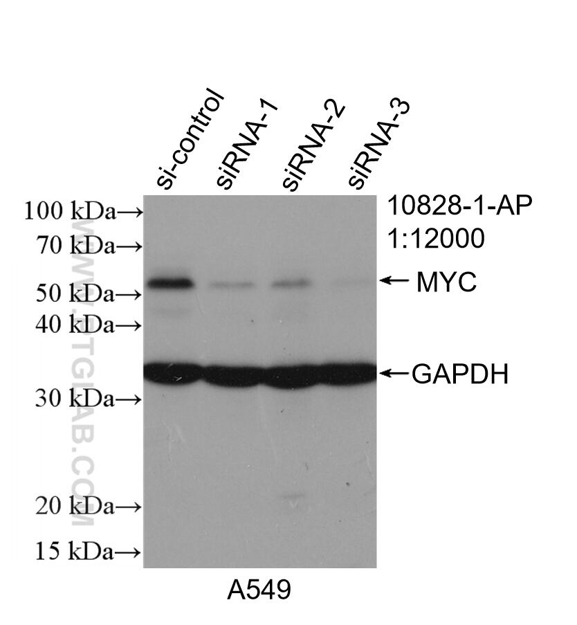 Western Blot (WB) analysis of A549 cells using c-MYC Polyclonal antibody (10828-1-AP)