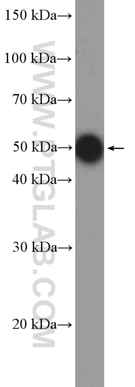 WB analysis of HL-60 using 10828-1-AP