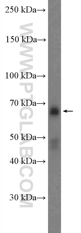 Western Blot (WB) analysis of human placenta tissue using c-MYC Polyclonal antibody (10828-1-AP)