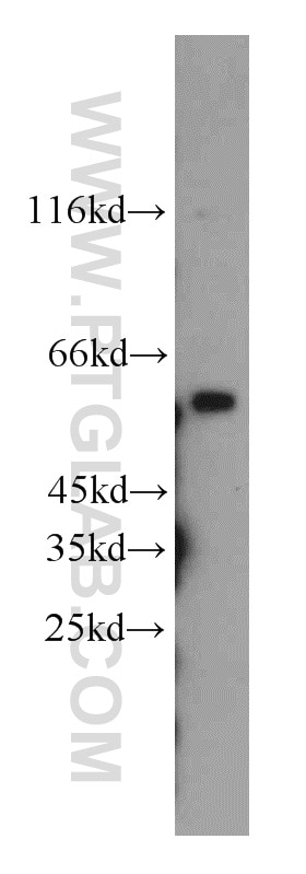 c-MYC Polyclonal antibody