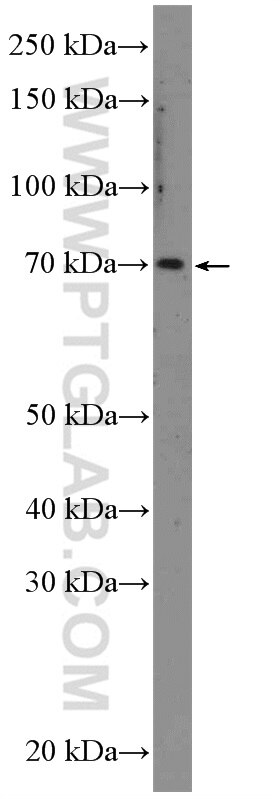 Western Blot (WB) analysis of HeLa cells using MYC Polyclonal antibody (26197-1-AP)