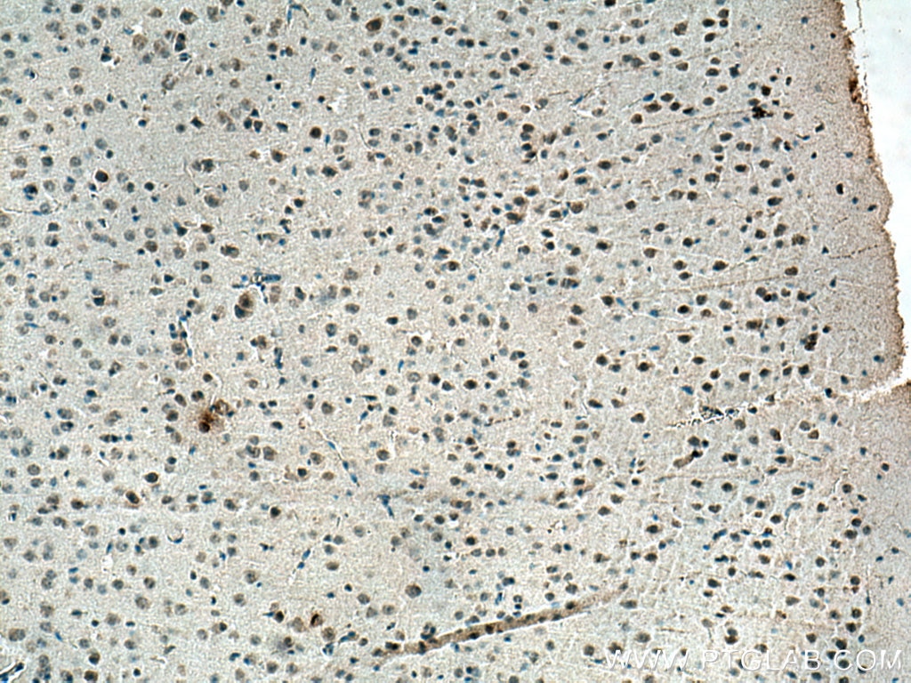 Immunohistochemistry (IHC) staining of mouse brain tissue using c-MYC Monoclonal antibody (67447-1-Ig)