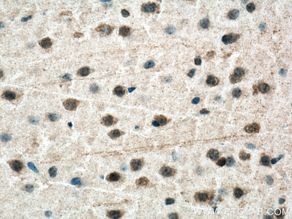 Immunohistochemistry (IHC) staining of mouse brain tissue using c-MYC Monoclonal antibody (67447-1-Ig)