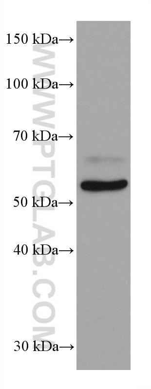 Western Blot (WB) analysis of 4T1 cells using c-MYC Monoclonal antibody (67447-1-Ig)