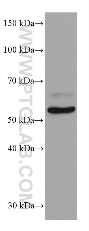 WB analysis of 4T1 using 67447-1-Ig