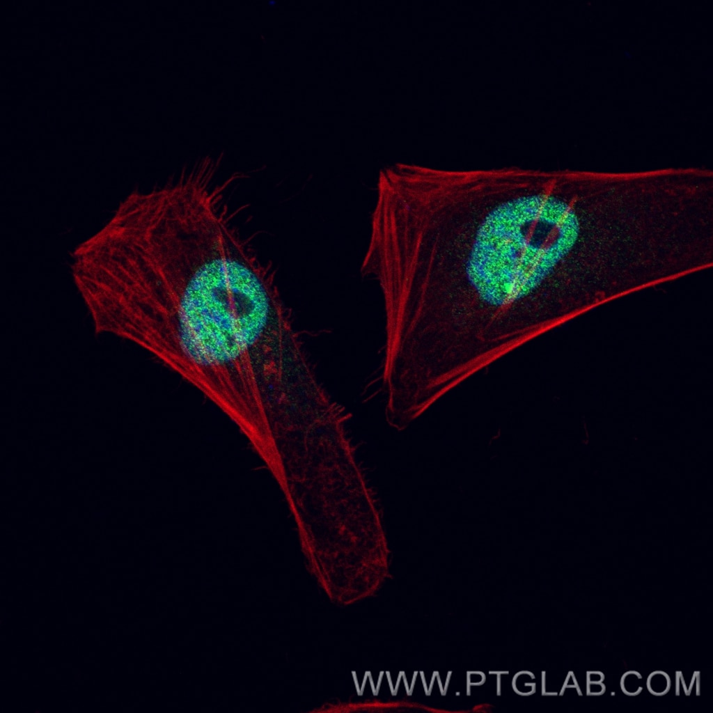 Immunofluorescence (IF) / fluorescent staining of HeLa cells using c-MYC Recombinant antibody (80845-1-RR)