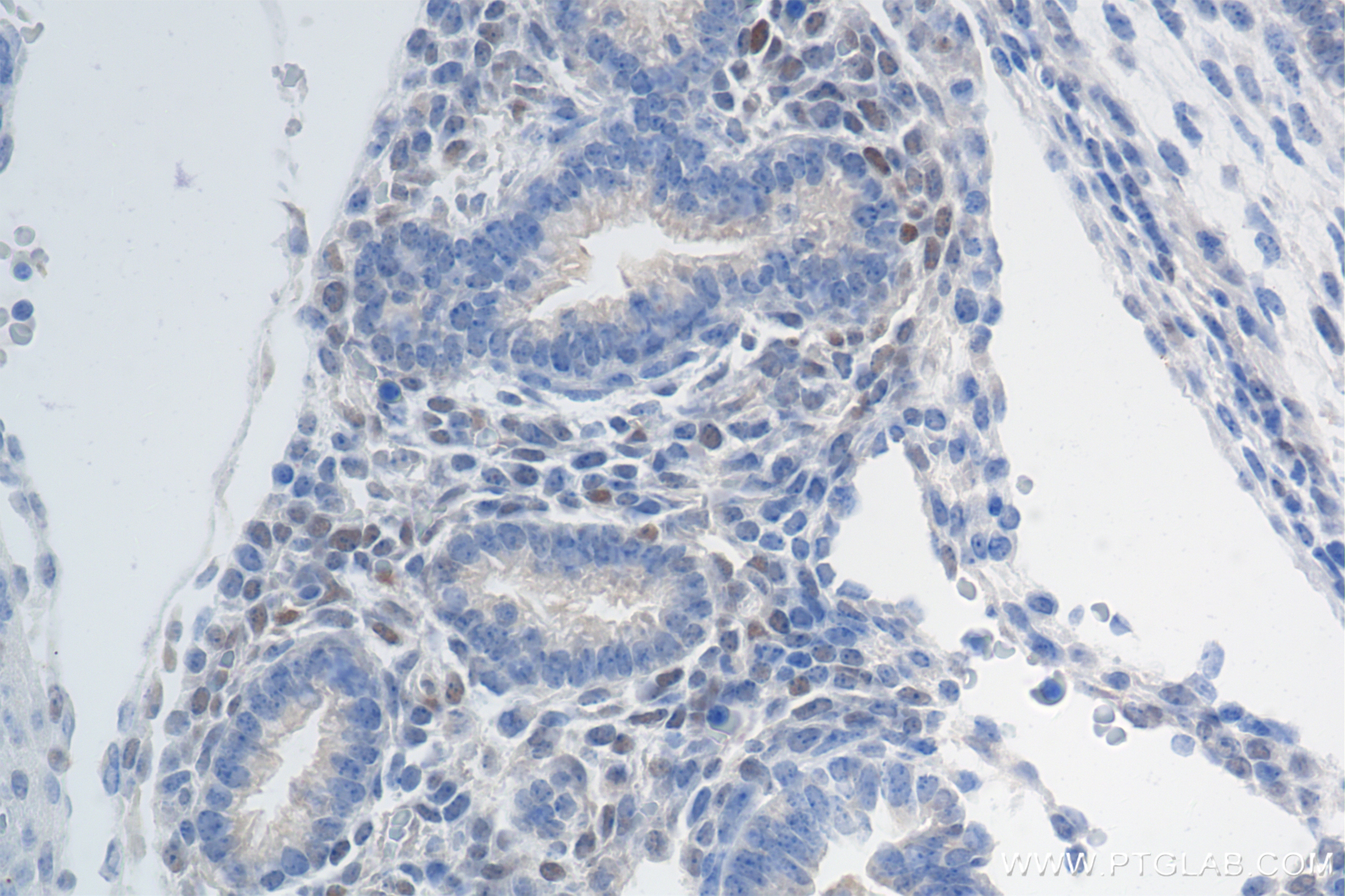 Immunohistochemistry (IHC) staining of mouse embryo tissue using c-MYC Recombinant antibody (80845-1-RR)