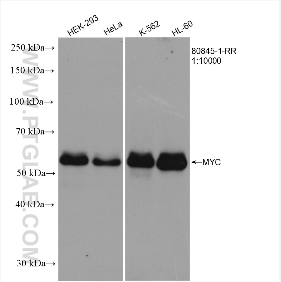 WB analysis using 80845-1-RR