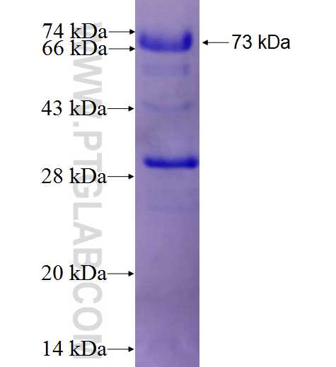 MYC fusion protein Ag1263 SDS-PAGE