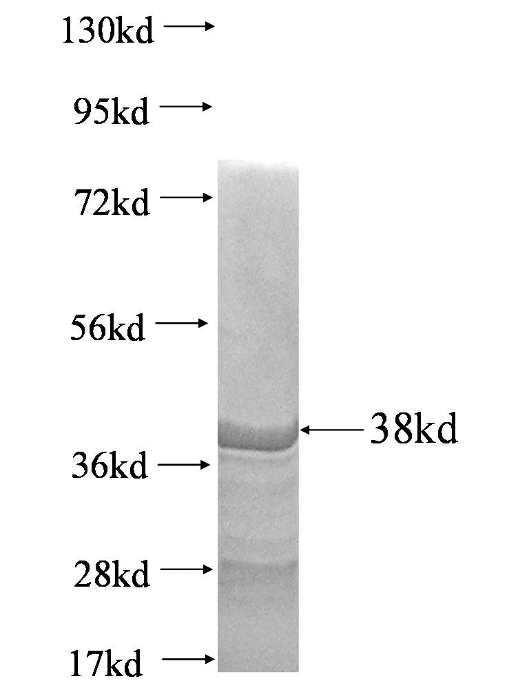 MYC fusion protein Ag1462 SDS-PAGE