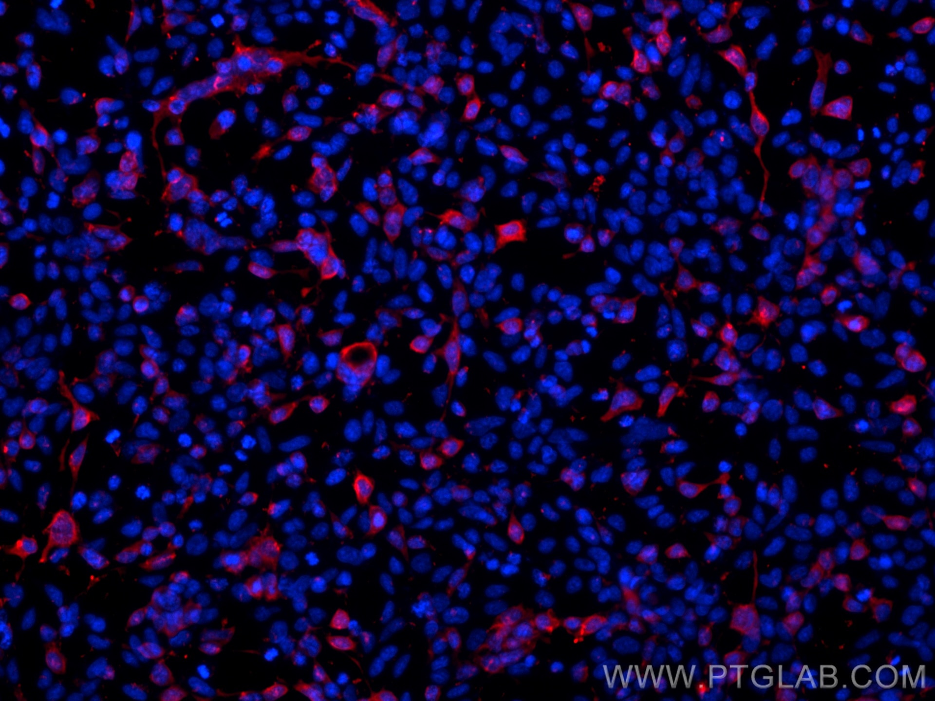 Immunofluorescence (IF) / fluorescent staining of Transfected HEK-293 cells using MYC tag Polyclonal antibody (16286-1-AP)