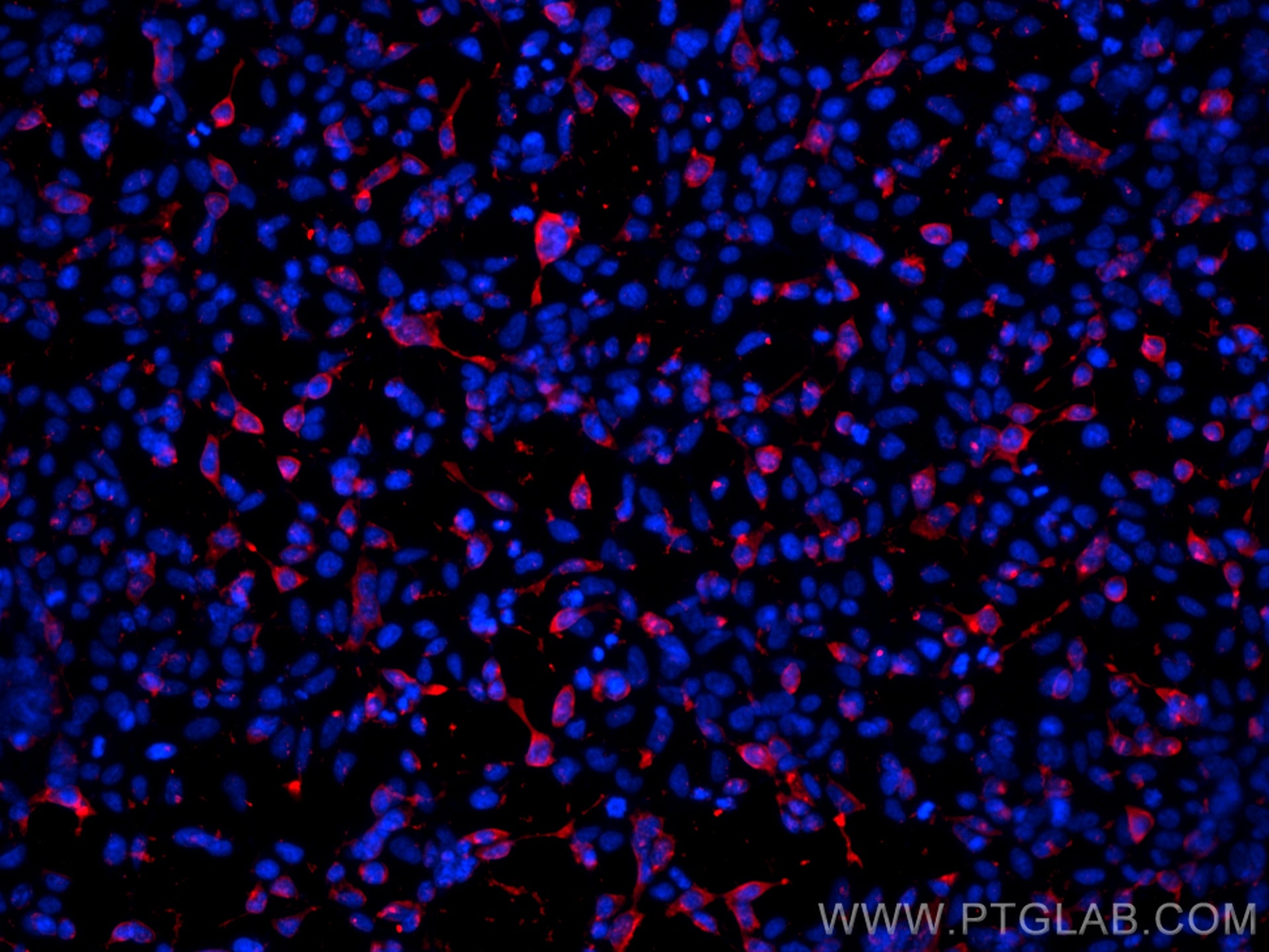 Immunofluorescence (IF) / fluorescent staining of Transfected HEK-293 cells using MYC tag Polyclonal antibody (16286-1-AP)