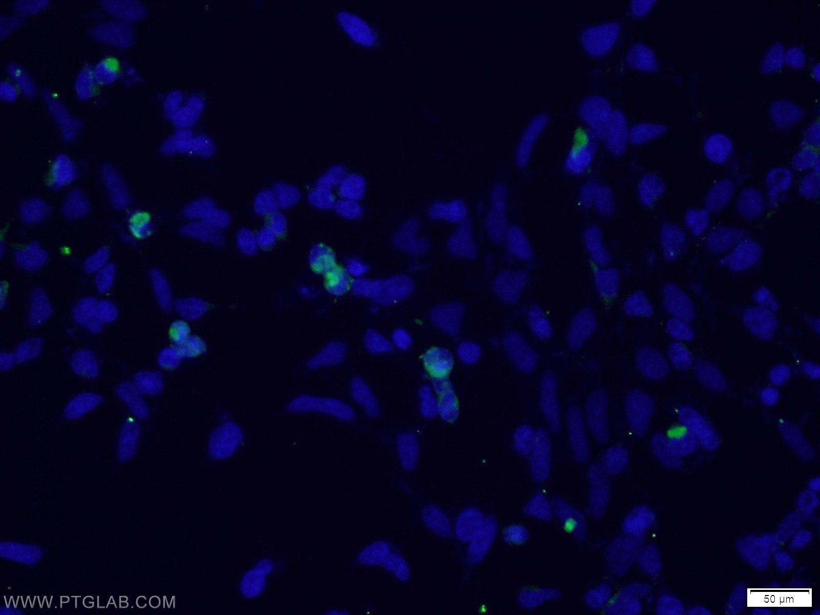 Immunofluorescence (IF) / fluorescent staining of Transfected HEK-293 cells using MYC-tag Monoclonal antibody (66004-1-Ig)