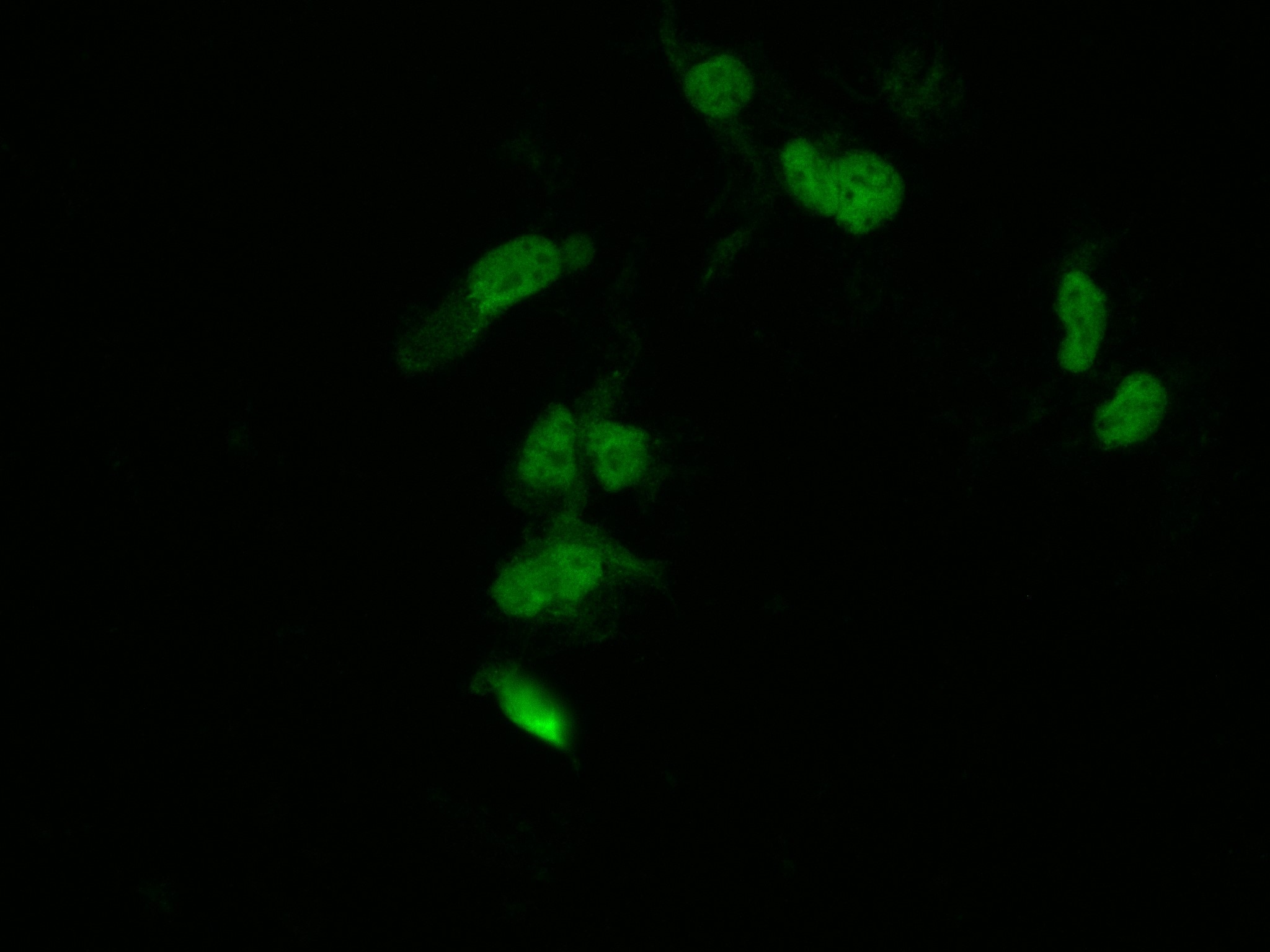 Immunofluorescence (IF) / fluorescent staining of Transfected HEK-293 cells using MYC tag Recombinant antibody (80469-2-RR)