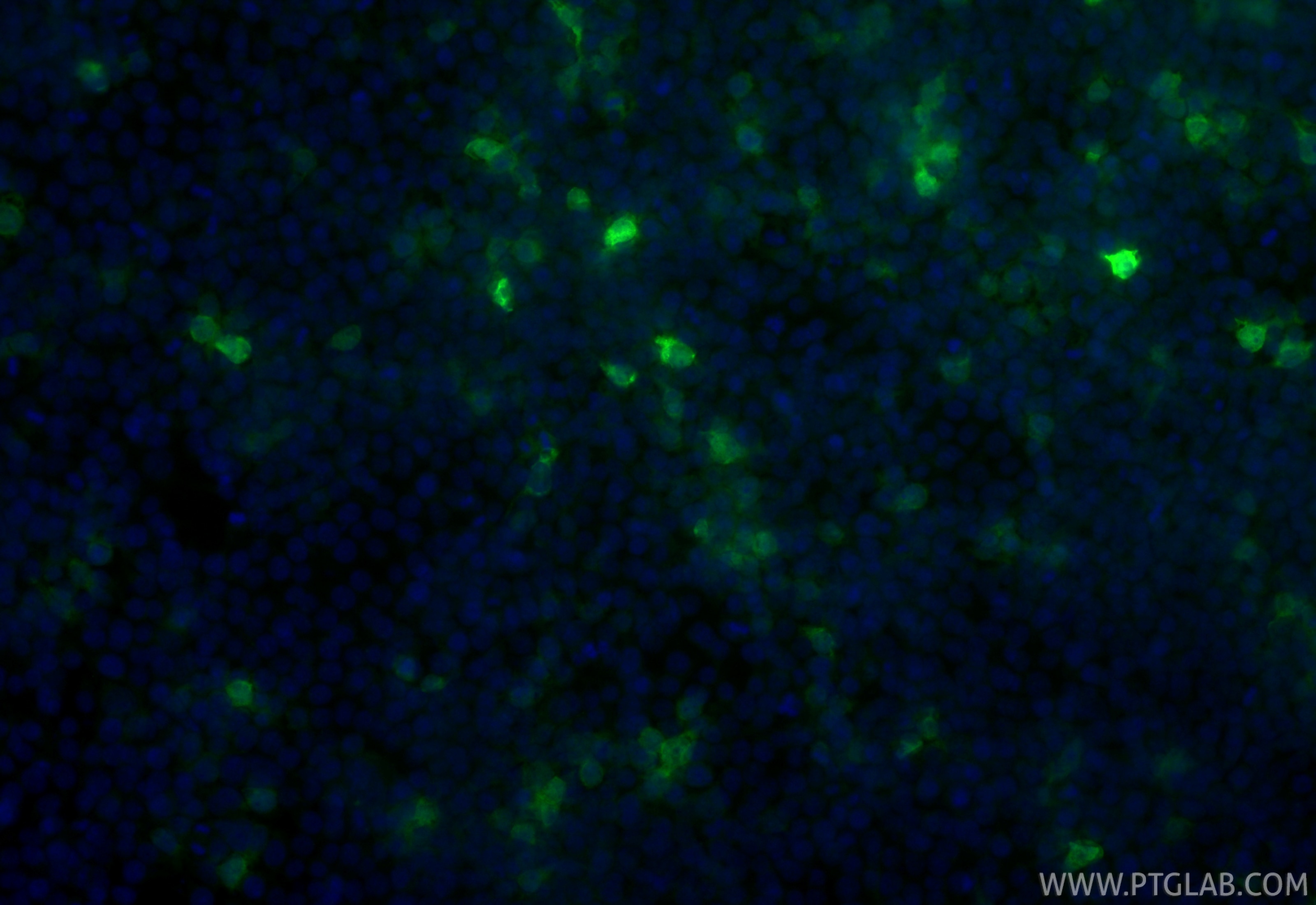 Immunofluorescent analysis of (-20°C Ethanol) fixed Transfected HEK-293 cells using CoraLite® Plus 488 MYC tag antibody (CL488-80469-2, Clone: 241611D1 ) at dilution of 1:200. Immunofluorescence (IF) / fluorescent staining of Transfected HEK-293 cells using CoraLite® Plus 488-conjugated MYC tag Recombinant (CL488-80469-2)