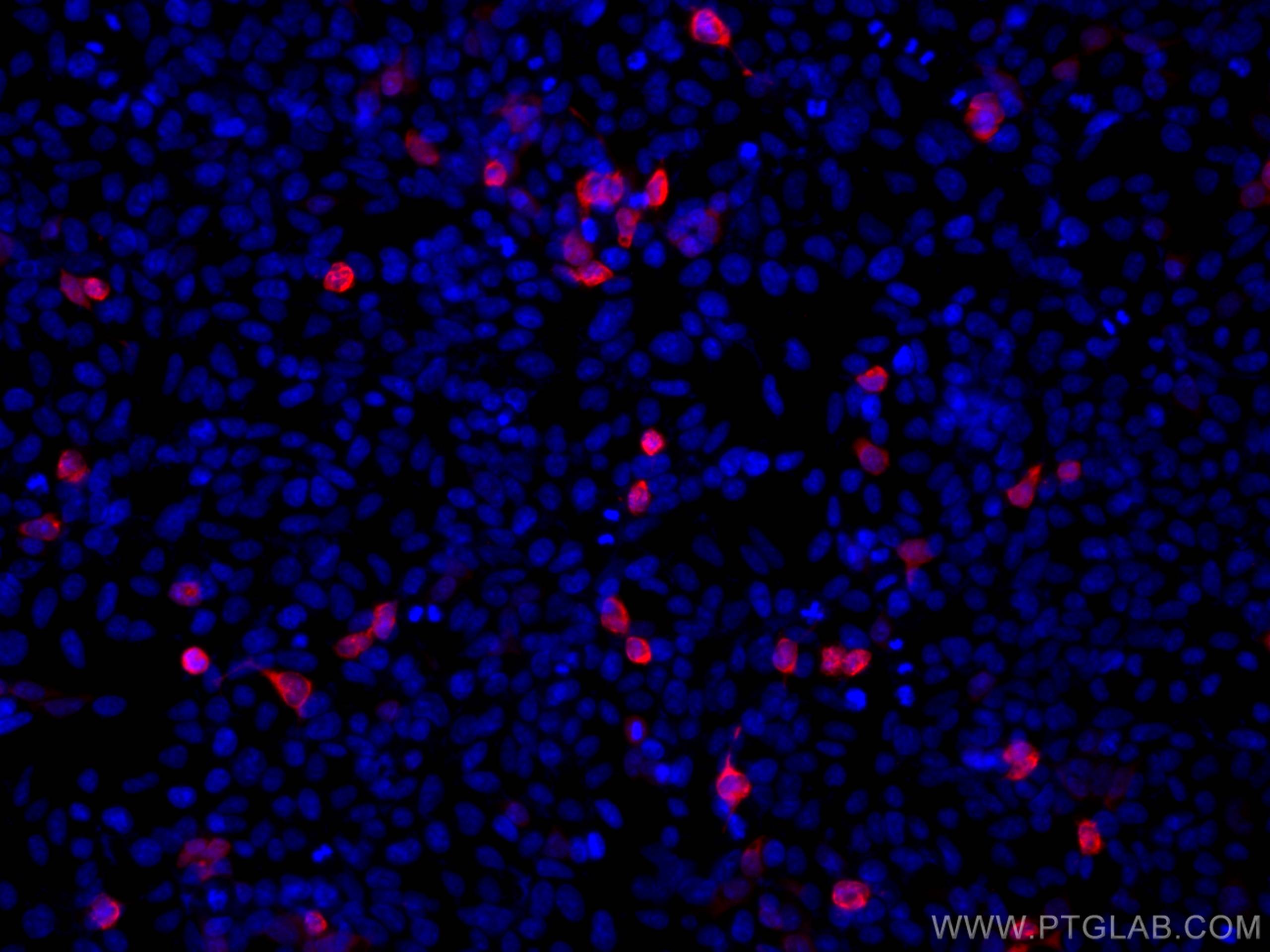 Immunofluorescence (IF) / fluorescent staining of Transfected HEK-293 cells using CoraLite® Plus 647-conjugated MYC tag Monoclonal a (CL647-60003)