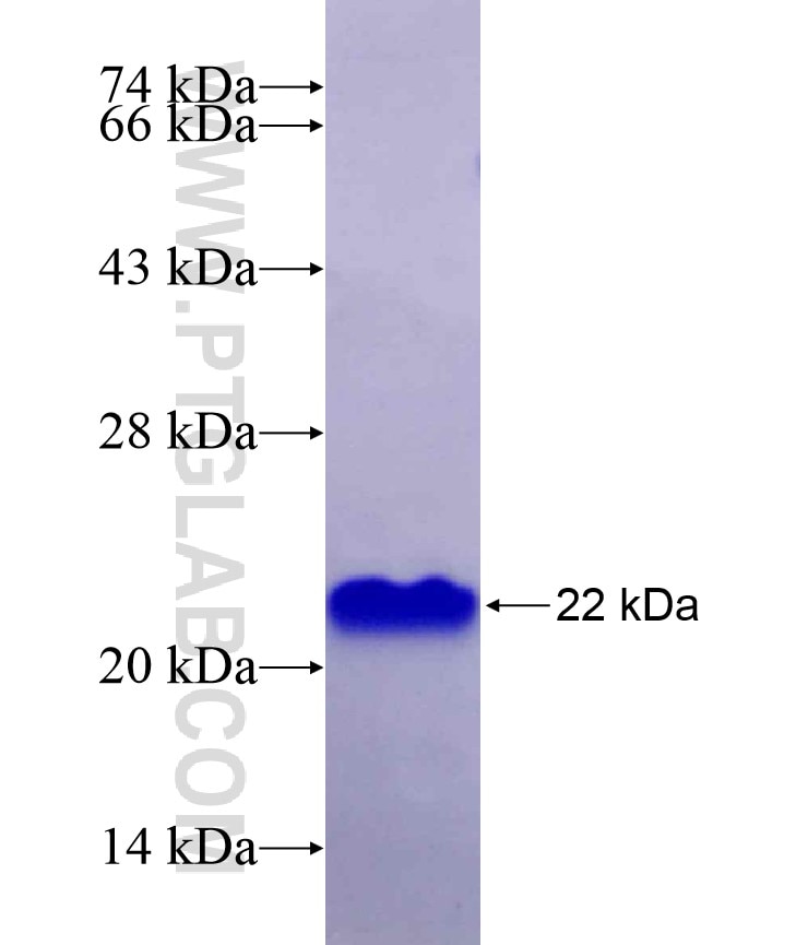 MYC-tag fusion protein Ag9431 SDS-PAGE