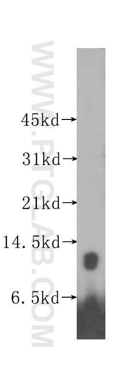 Western Blot (WB) analysis of human kidney tissue using MYCBP Polyclonal antibody (12022-1-AP)