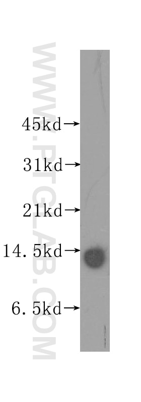 WB analysis of human lung using 12022-1-AP