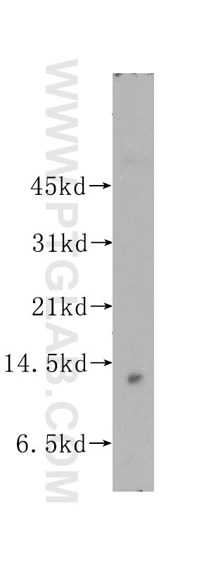 Western Blot (WB) analysis of human placenta tissue using MYCBP Polyclonal antibody (12022-1-AP)