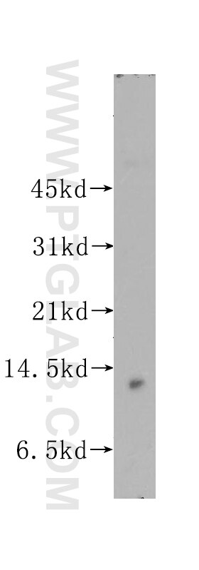 Western Blot (WB) analysis of human placenta tissue using MYCBP Polyclonal antibody (12022-1-AP)